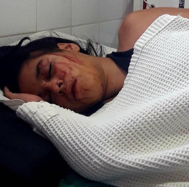 Feroz golpiza a una chica de 16 años 1 20200309 100418